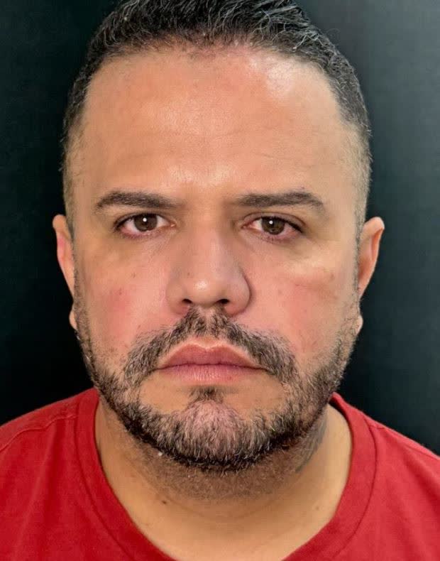Rosto masculino depois do lift facial