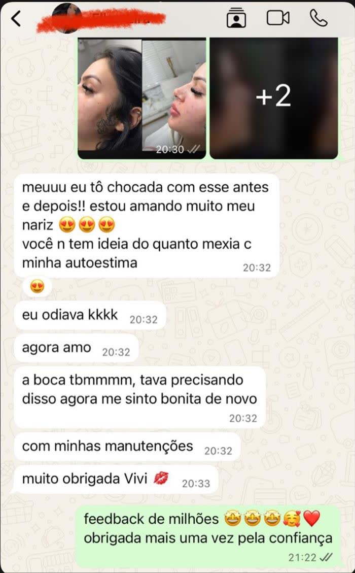 Print de conversa no WhatsApp: paciente elogia o resultado do nariz e da boca